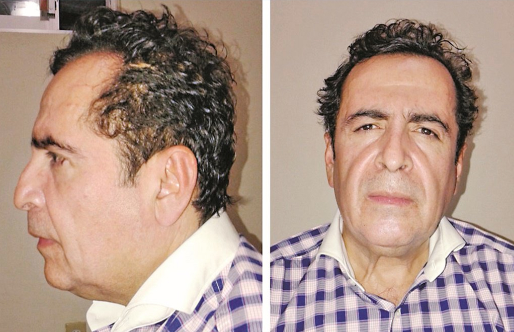 Antes de estar preso, Héctor Beltrán Leyva libró una guerra contra la organización criminal de su primo, Joaquín Guzmán Loera
