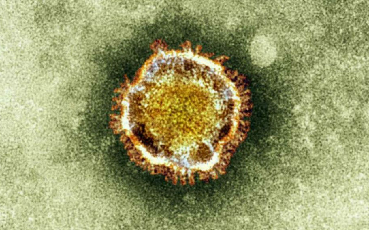 Una imagen de archivo de un coronavirus en el microscopio electrónico. | Foto: Reuters / Voz de América