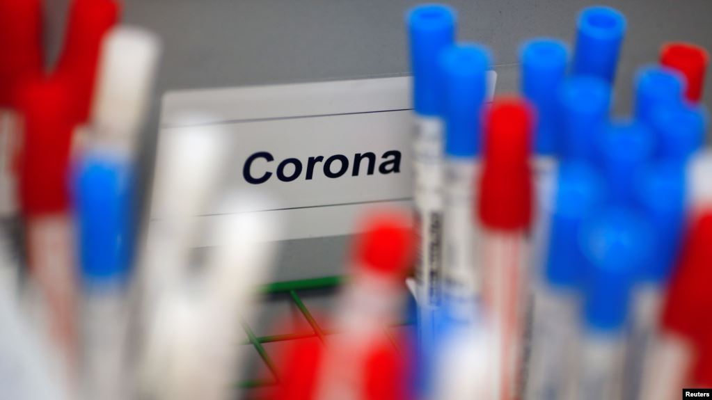 FDA autoriza uso de emergencia de pruebas rápidas para coronavirus