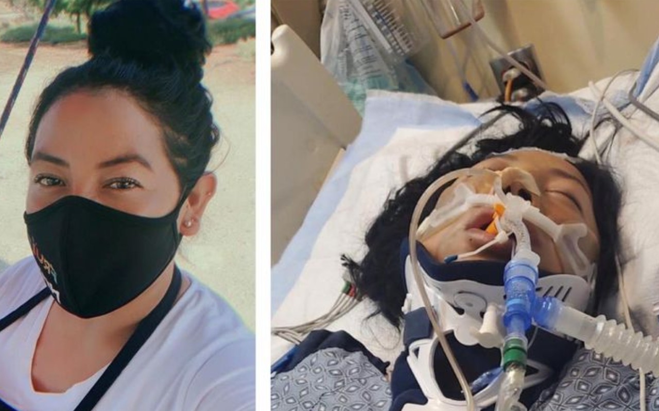 Vendedora ambulante queda en estado de coma luego de ser atropellada