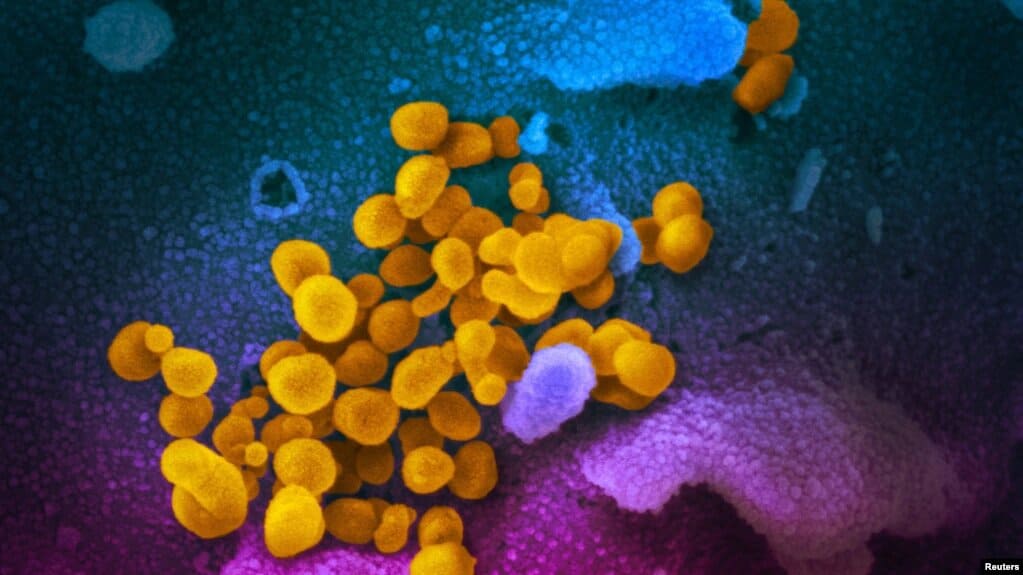 El virus del Covid-19 a través de un microscopio. | Foto: VOA/Reuters.