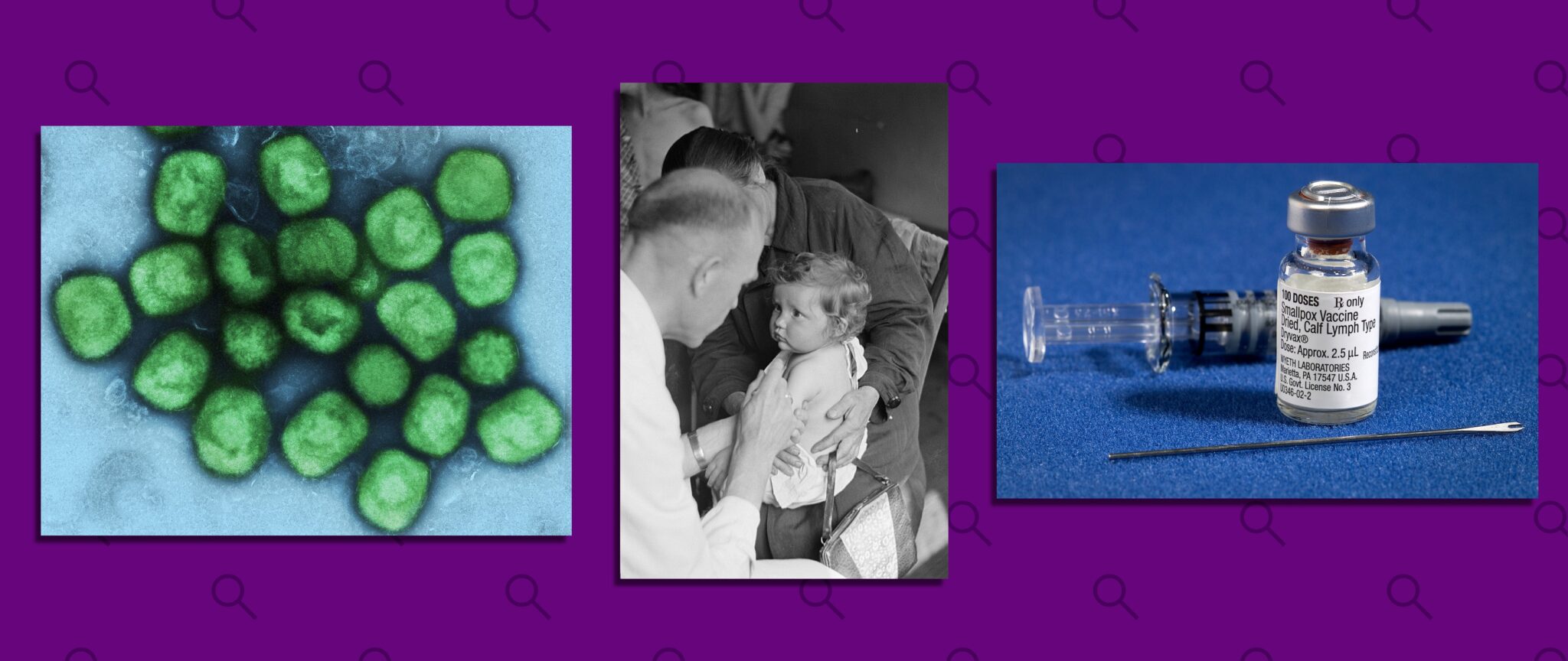 La vacuna de la viruela podría tener efecto para combatir la viruela de mono | Imagen: Factchequeado